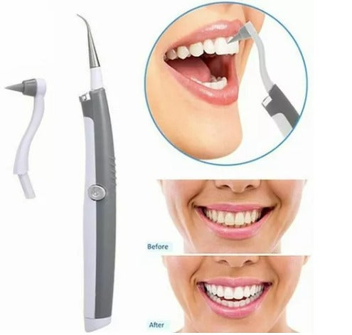 Limpiador Dental Sonic Pic con luz LED - additional image 4